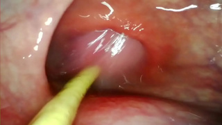 EXTREME ANAL POINT OF VIEW. ONLINE CAMERA INSIDE HER ASS-HOLE AS I POUND HER WITH MY MONSTROUS DONG AND JIZZ DEEP INSIDE