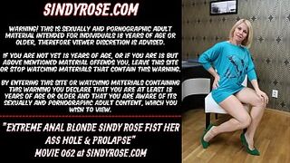 Extreme anal blonde Sindy Rose fist her butt hole & prolapse