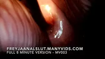 Home-Made FreyjaAnalslut : Cervical Spreading - Opening Freyja's vagina showing you her tight cervix, and then opening Freyja's cervix with a speculum - Full version on ManyVids