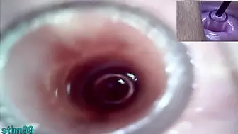 Lesbians Extreme Cervix Play and Peehole Fucking Prick Dildo